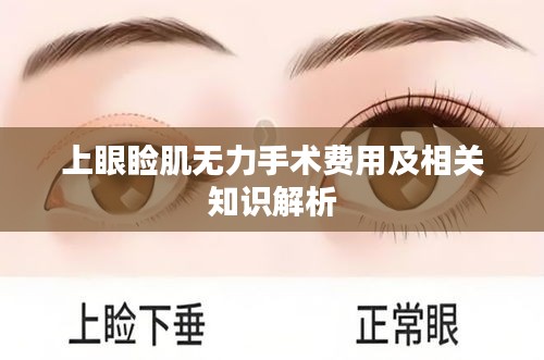 上眼睑肌无力手术费用及相关知识解析