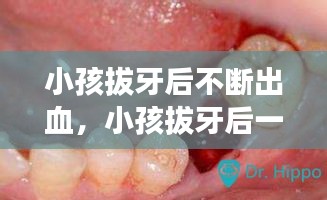 小孩拔牙后不断出血，小孩拔牙后一直流血怎么处理 